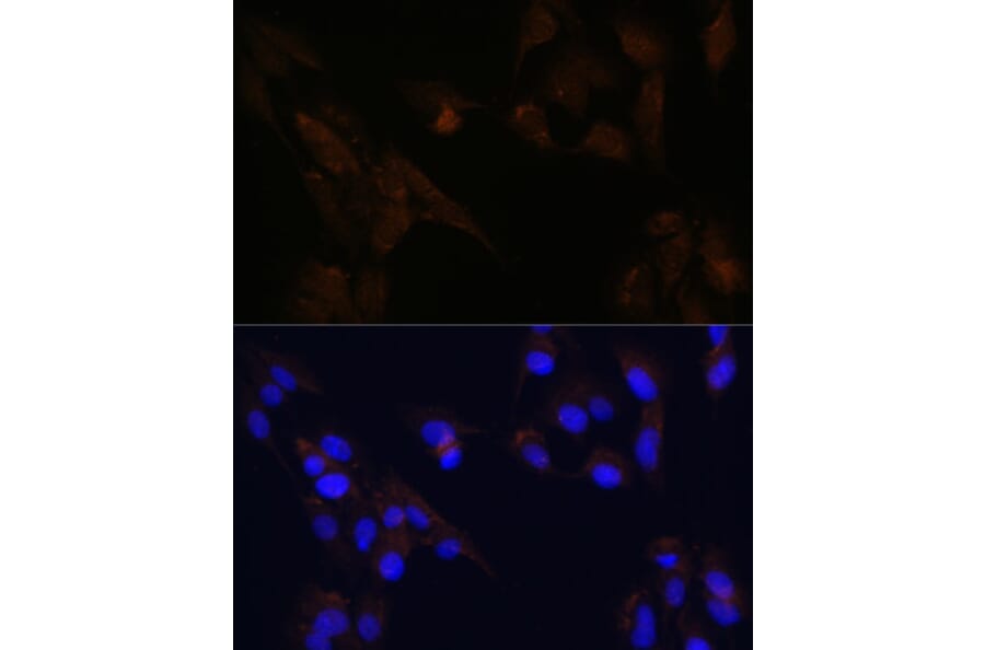 Immunofluorescence - Anti-CD133 Antibody (A305371) - Antibodies.com