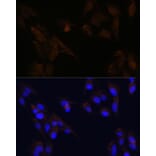 Immunofluorescence - Anti-CD133 Antibody (A305371) - Antibodies.com