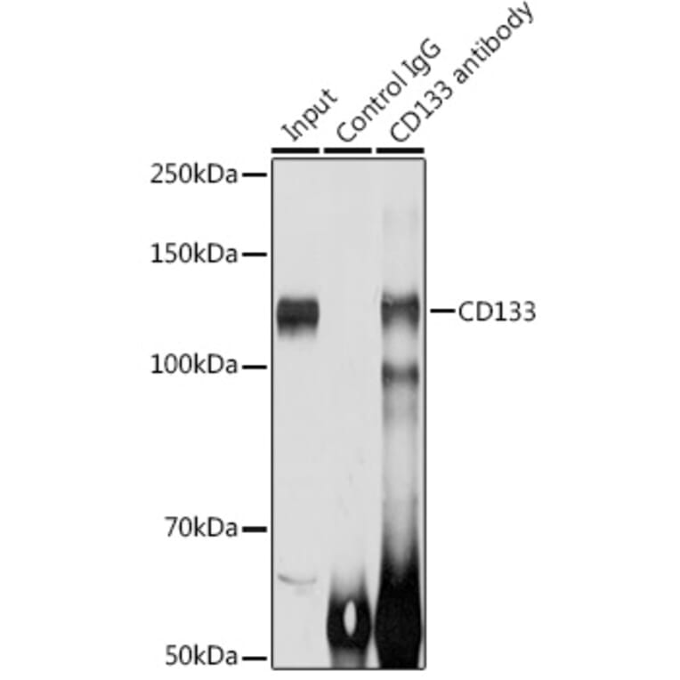 Western Blot - Anti-CD133 Antibody (A305371) - Antibodies.com