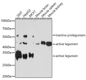 Western Blot - Anti-Legumain Antibody [ARC1864] (A305372) - Antibodies.com
