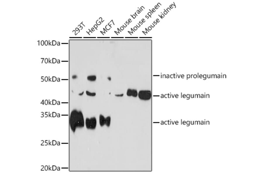 Western Blot - Anti-Legumain Antibody [ARC1864] (A305372) - Antibodies.com