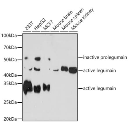 Western Blot - Anti-Legumain Antibody [ARC1864] (A305372) - Antibodies.com