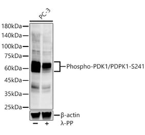 Western Blot - Anti-PDPK1 (phospho Ser241) Antibody [ARC57184] (A305373) - Antibodies.com