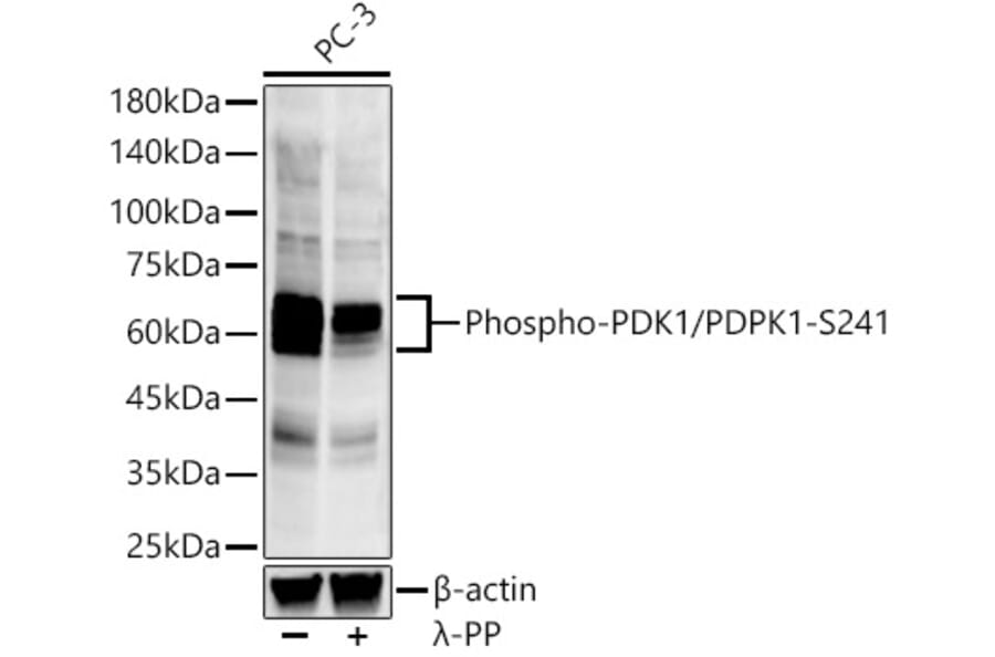 Western Blot - Anti-PDPK1 (phospho Ser241) Antibody [ARC57184] (A305373) - Antibodies.com