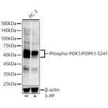 Western Blot - Anti-PDPK1 (phospho Ser241) Antibody [ARC57184] (A305373) - Antibodies.com