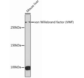 Western Blot - Anti-Von Willebrand Factor Antibody (A305374) - Antibodies.com