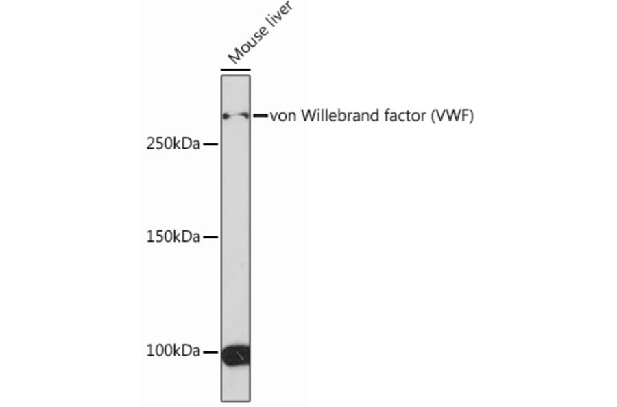 Western Blot - Anti-Von Willebrand Factor Antibody [ARC0716] (A305374) - Antibodies.com