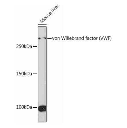 Western Blot - Anti-Von Willebrand Factor Antibody [ARC0716] (A305374) - Antibodies.com