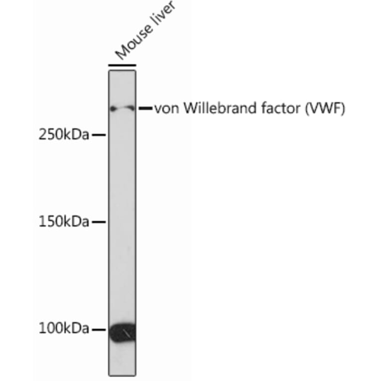 Western Blot - Anti-Von Willebrand Factor Antibody [ARC0716] (A305374) - Antibodies.com