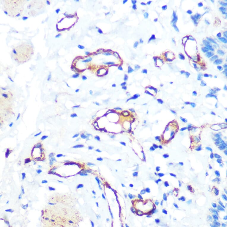 Immunohistochemistry - Anti-Von Willebrand Factor Antibody [ARC0716] (A305374) - Antibodies.com