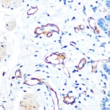 Immunohistochemistry - Anti-Von Willebrand Factor Antibody [ARC0716] (A305374) - Antibodies.com