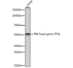 Western Blot - Anti-TRK fused gene Antibody [ARC1882] (A305376) - Antibodies.com