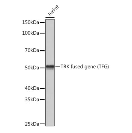 Western Blot - Anti-TRK fused gene Antibody [ARC1882] (A305376) - Antibodies.com