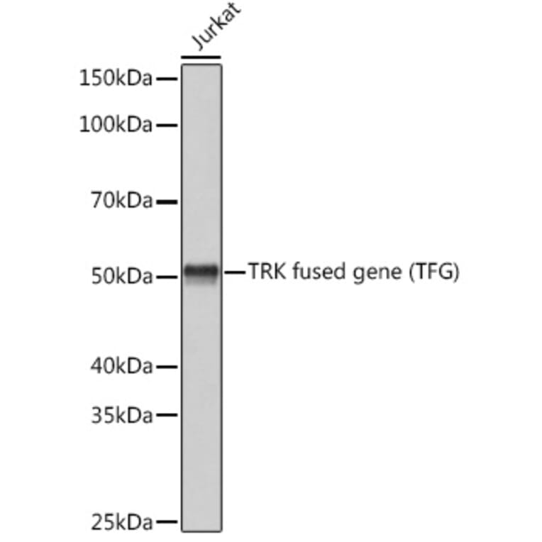 Western Blot - Anti-TRK fused gene Antibody [ARC1882] (A305376) - Antibodies.com