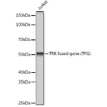 Western Blot - Anti-TRK fused gene Antibody [ARC1882] (A305376) - Antibodies.com