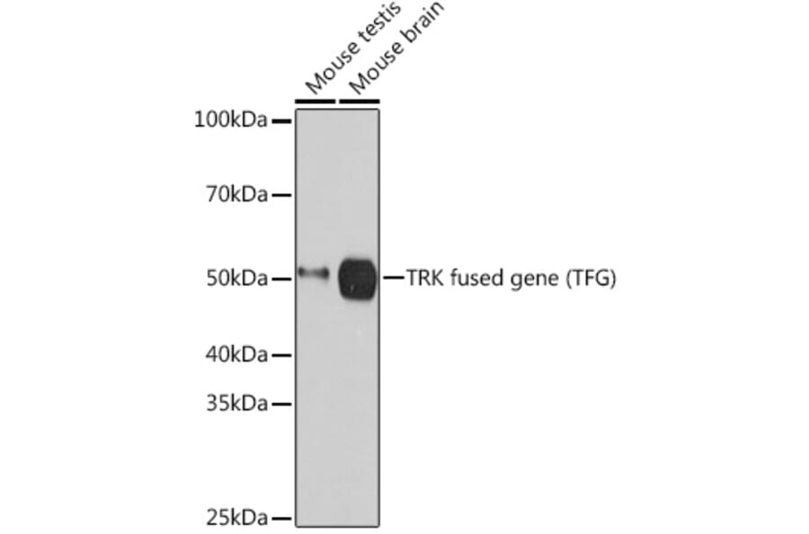 Western Blot - Anti-TRK fused gene Antibody [ARC1882] (A305376) - Antibodies.com