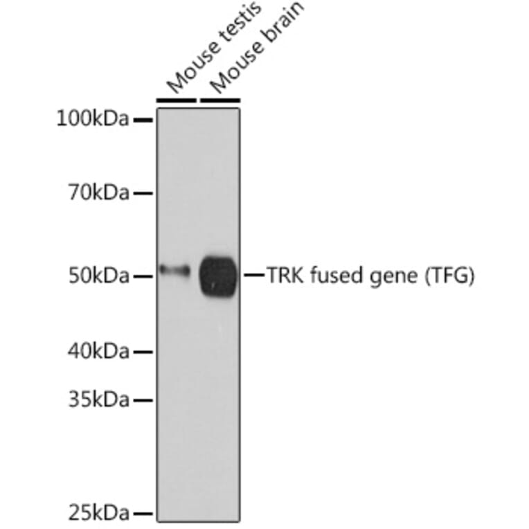 Western Blot - Anti-TRK fused gene Antibody [ARC1882] (A305376) - Antibodies.com