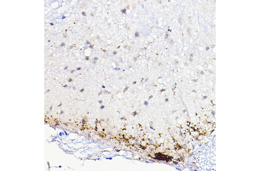 Immunohistochemistry - Anti-CGRP Antibody (A305378) - Antibodies.com
