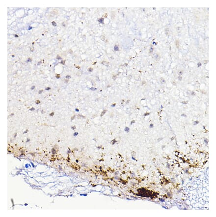 Immunohistochemistry - Anti-CGRP Antibody (A305378) - Antibodies.com