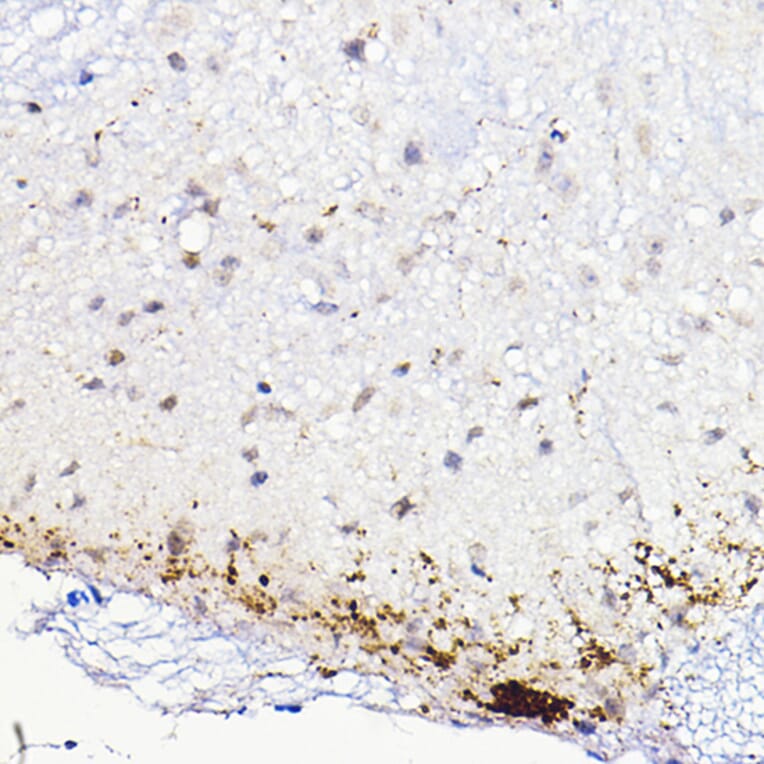 Immunohistochemistry - Anti-CGRP Antibody (A305378) - Antibodies.com