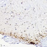 Immunohistochemistry - Anti-CGRP Antibody (A305378) - Antibodies.com