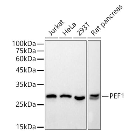 Western Blot - Anti-PEF1 Antibody [ARC2886] (A305379) - Antibodies.com