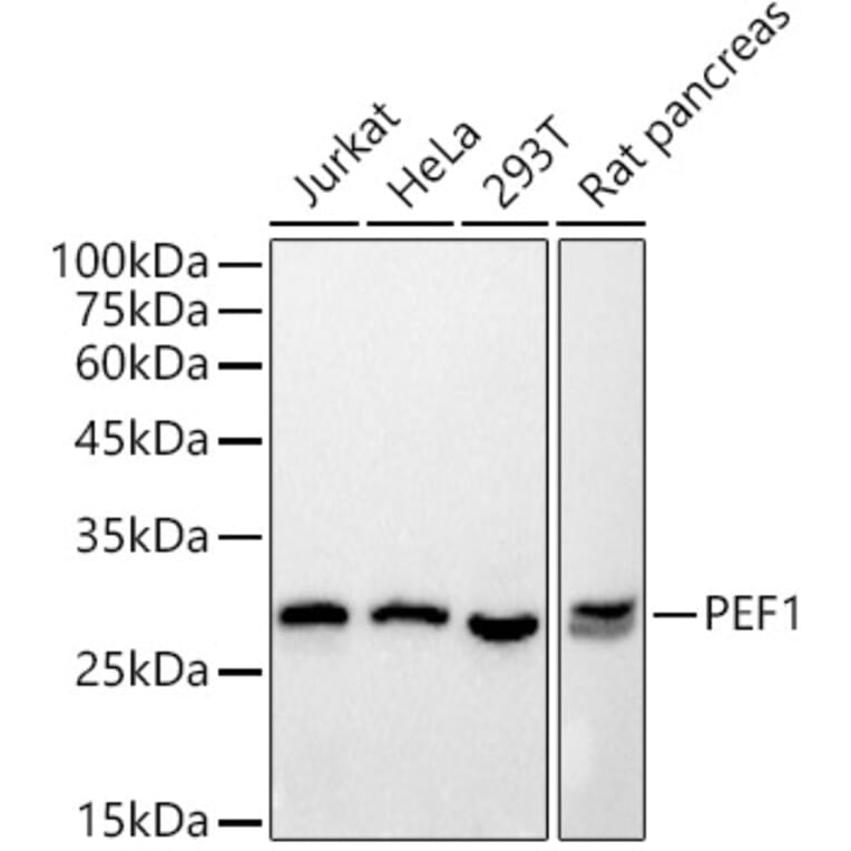 Western Blot - Anti-PEF1 Antibody [ARC2886] (A305379) - Antibodies.com