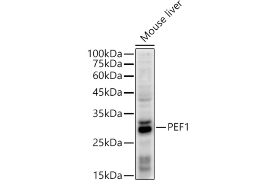 Western Blot - Anti-PEF1 Antibody [ARC2886] (A305379) - Antibodies.com