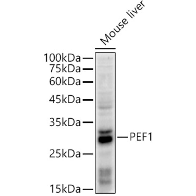 Western Blot - Anti-PEF1 Antibody [ARC2886] (A305379) - Antibodies.com
