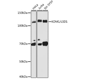 Western Blot - Anti-KDM1 / LSD1 Antibody [ARC1160] (A305380) - Antibodies.com