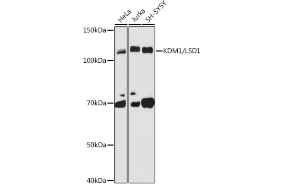 Western Blot - Anti-KDM1/LSD1 Antibody [ARC1160] (A305380) - Antibodies.com