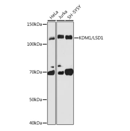 Western Blot - Anti-KDM1 / LSD1 Antibody [ARC1160] (A305380) - Antibodies.com