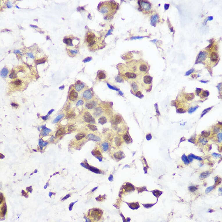 Immunohistochemistry - Anti-KDM1/LSD1 Antibody [ARC1160] (A305380) - Antibodies.com