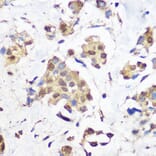 Immunohistochemistry - Anti-KDM1/LSD1 Antibody [ARC1160] (A305380) - Antibodies.com