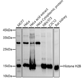 Western Blot - Anti-Histone H2B Antibody (A305381) - Antibodies.com