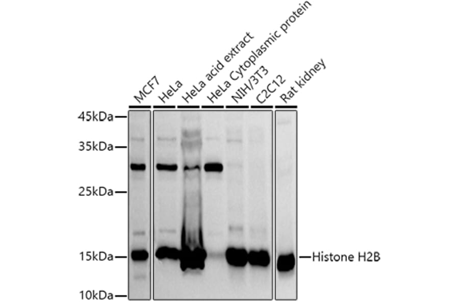 Western Blot - Anti-Histone H2B Antibody (A305381) - Antibodies.com