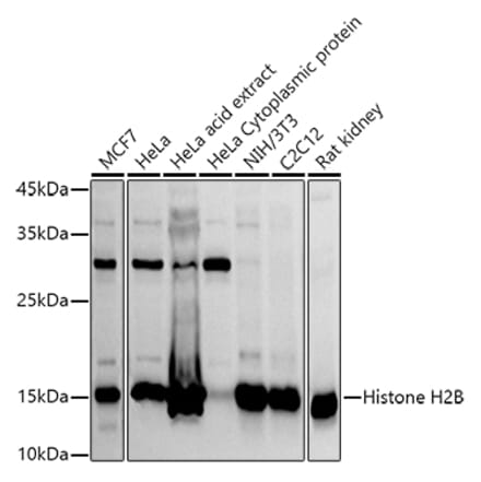 Western Blot - Anti-Histone H2B Antibody (A305381) - Antibodies.com