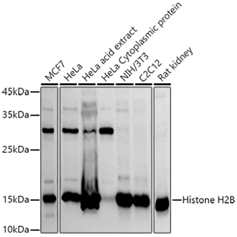 Western Blot - Anti-Histone H2B Antibody (A305381) - Antibodies.com