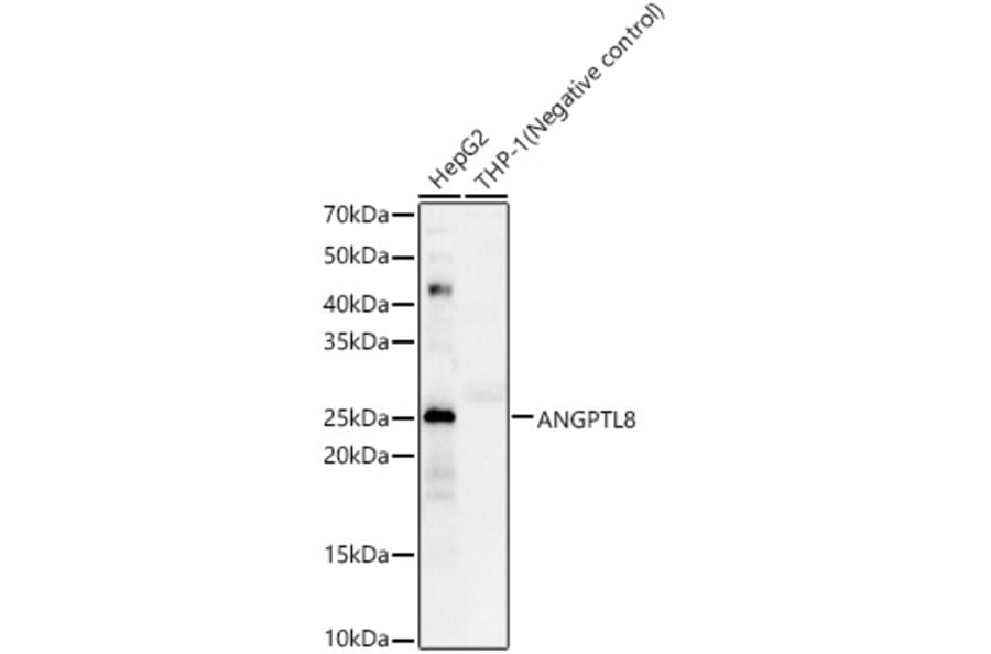Western Blot - Anti-Betatrophin Antibody (A305382) - Antibodies.com
