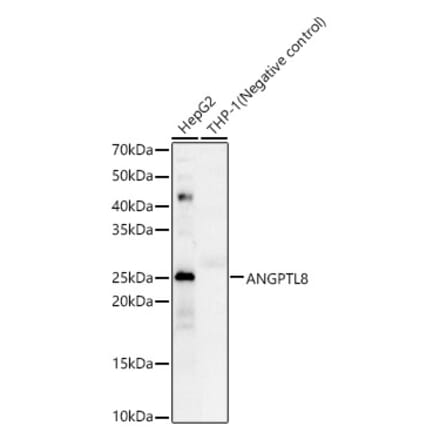 Western Blot - Anti-Betatrophin Antibody (A305382) - Antibodies.com