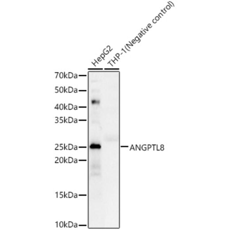 Western Blot - Anti-Betatrophin Antibody (A305382) - Antibodies.com