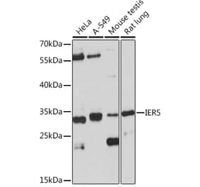 Western Blot - Anti-IER5 Antibody (A305383) - Antibodies.com