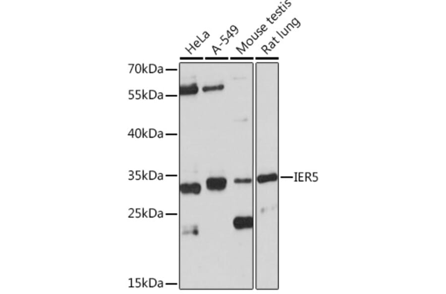 Western Blot - Anti-IER5 Antibody (A305383) - Antibodies.com
