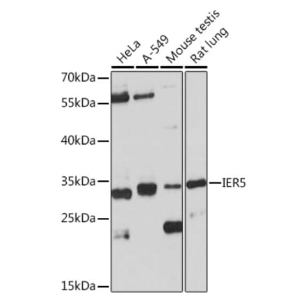 Western Blot - Anti-IER5 Antibody (A305383) - Antibodies.com