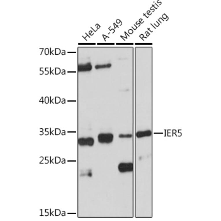 Western Blot - Anti-IER5 Antibody (A305383) - Antibodies.com