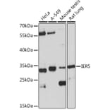 Western Blot - Anti-IER5 Antibody (A305383) - Antibodies.com