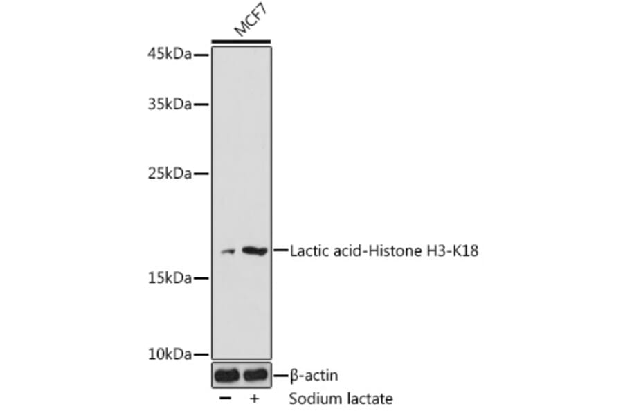 Western Blot - Anti-Histone H3 (lactyl Lys18) Antibody (A305386) - Antibodies.com