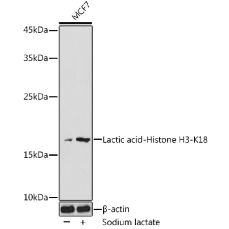 Western Blot - Anti-Histone H3 (lactyl Lys18) Antibody (A305386) - Antibodies.com