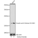 Western Blot - Anti-Histone H3 (lactyl Lys18) Antibody (A305386) - Antibodies.com