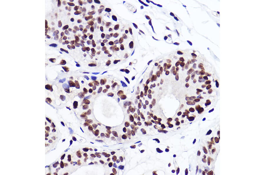 Immunohistochemistry - Anti-Histone H3 (mono methyl Lys18) Antibody [ARC2621] (A305387) - Antibodies.com